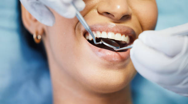 Best Emergency Wisdom Teeth Removal in Arapahoe, WY